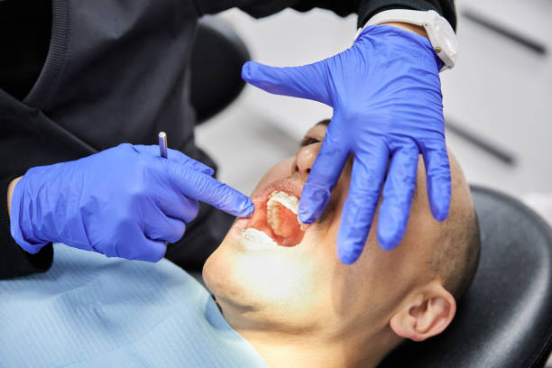 Best Urgent Care for Lost Fillings or Crowns in Olcott, NY